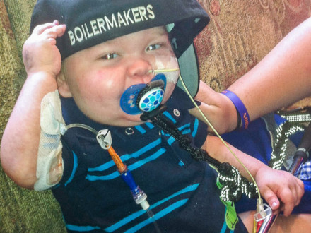 Two-year-old Conon Kennedy battles Crohn’s disease.